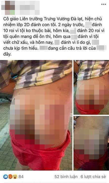 Cô giáo đánh học sinh bầm tím, phụ huynh tìm đến tận nhà đấm vào mắt cô-1