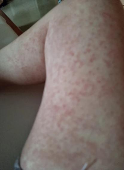 1 tháng kinh hoàng tự chiến đấu với Covid-19 của nghệ sĩ Phương Hoa-1