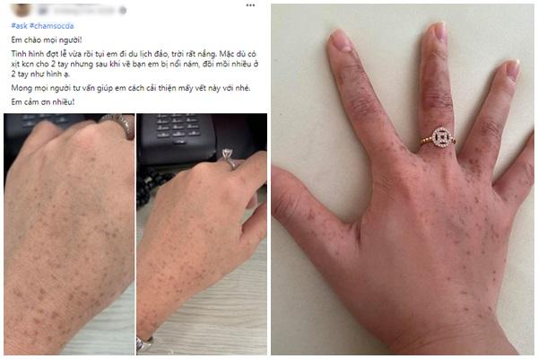 Tất tần tật về Retinol - trợ thủ skincare trị mụn, khóa nếp nhăn đỉnh cao-6