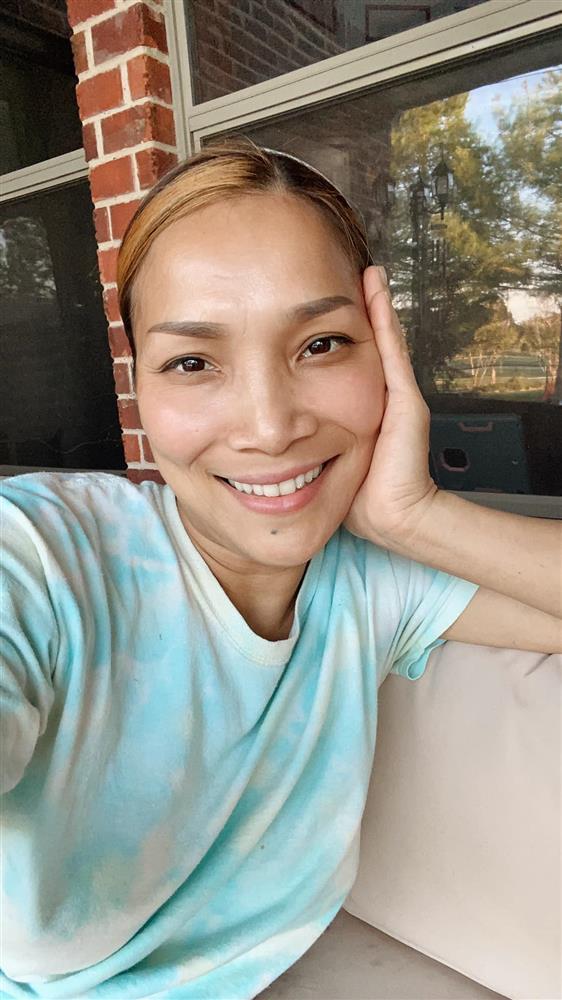 Cận cảnh gương mặt Hồng Ngọc sau 1 năm bị bỏng nặng-1