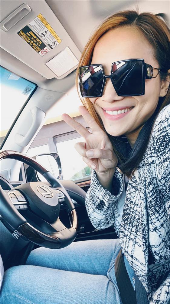 Cận cảnh gương mặt Hồng Ngọc sau 1 năm bị bỏng nặng-2