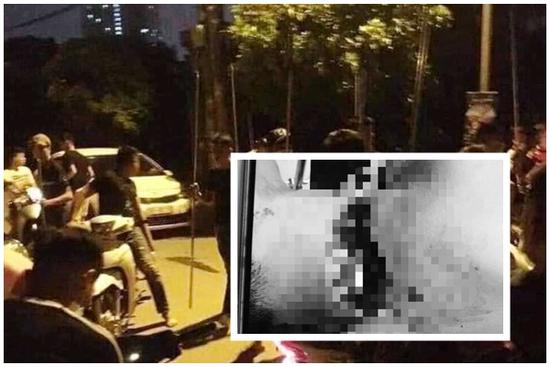 Thanh niên đang đi bị nhóm người chém nhầm, đứt nửa cổ