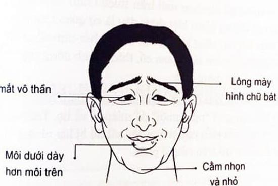 Đàn ông sở hữu 3 nét tướng này đau ốm liên miên, tán tài nghèo khổ