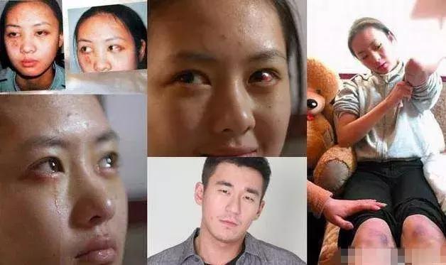 5 mỹ nhân Hoa ngữ bị người tình đánh đập hung tàn-7