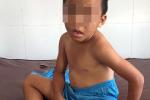 Giải cứu 7 đứa trẻ trần truồng, người bầm tím bị nhốt trong nhà chật hẹp-3