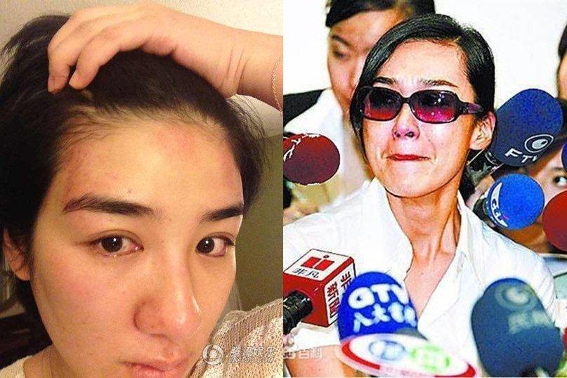 Idol Trung Quốc tiết lộ nguyên nhân ho ra máu trên livestream-3