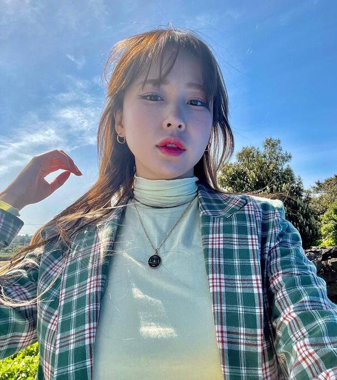 7 kiểu phẫu thuật thẩm mỹ phổ biến của sao Hàn-6