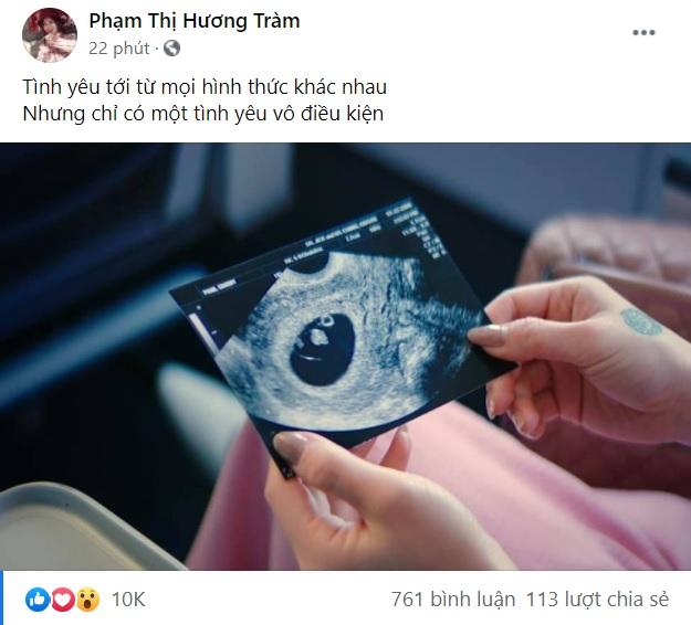 Hương Tràm công khai ảnh siêu âm, có thai sau 2 năm sang Mỹ?-1