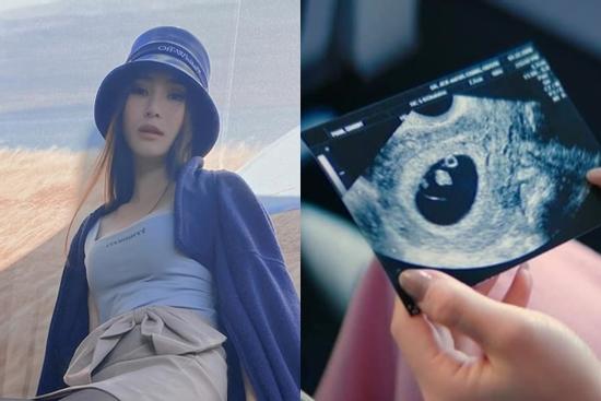 Hương Tràm công khai ảnh siêu âm, có thai sau 2 năm sang Mỹ?