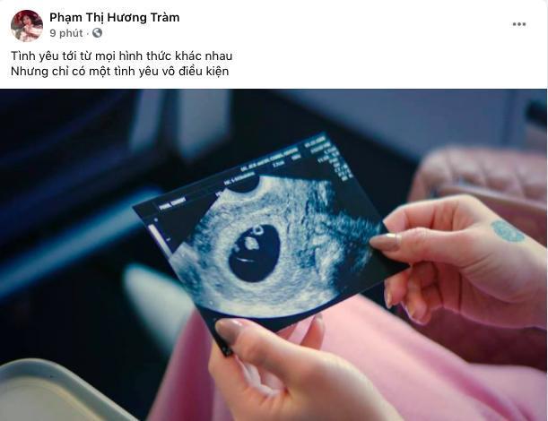 Hương Tràm chỉ đăng ảnh selfie, chân dung giữa nghi vấn bầu bí-1