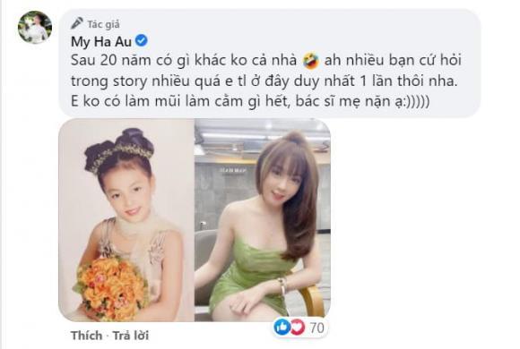 Lộ ảnh quá khứ khác hẳn hiện tại, Âu Hà My bị nghi sửa nát mặt-7