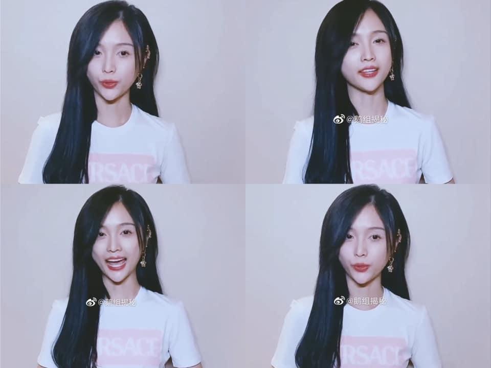 Ngô Tuyên Nghi lộ cằm nhọn hoắt, mặt hốc nhận không ra-1