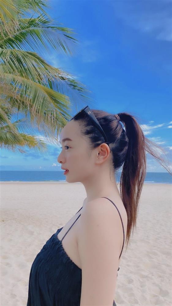 3 cách khắc phục nhược điểm trán dô như Kaity Nguyễn không cần dao kéo-2