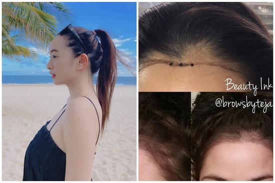 3 cách khắc phục nhược điểm trán dô như Kaity Nguyễn không cần 'dao kéo'