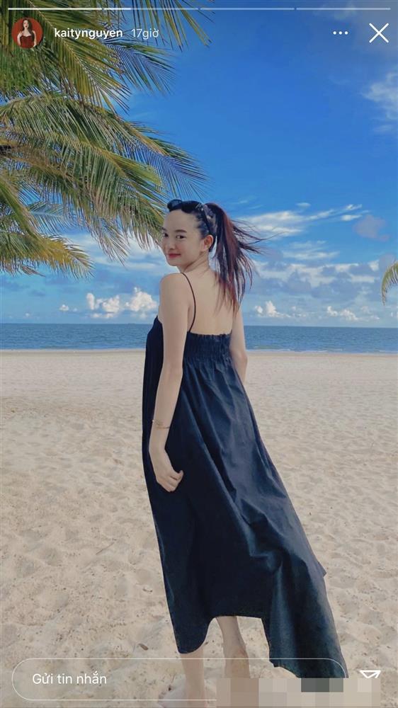 3 cách khắc phục nhược điểm trán dô như Kaity Nguyễn không cần dao kéo-1