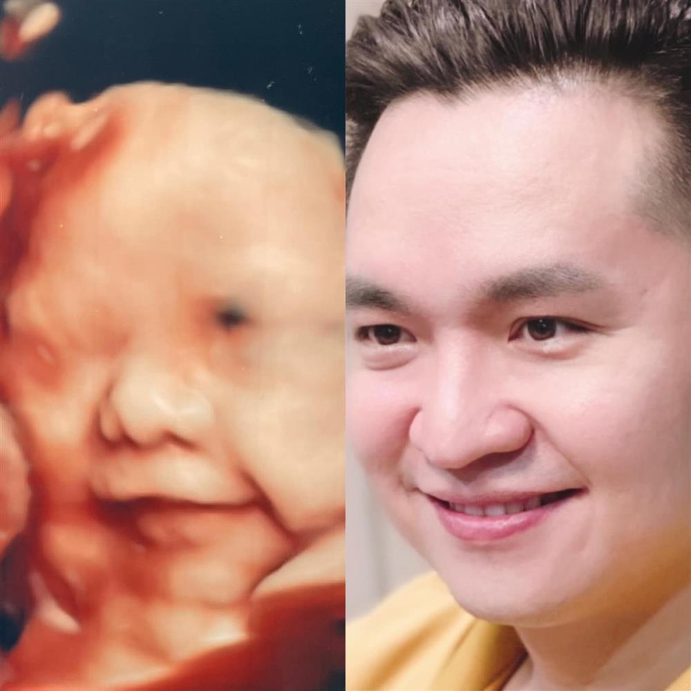 Dịch Covid-19 quậy phá, nam MC nhà đài được luôn cả nghé lẫn trâu-2