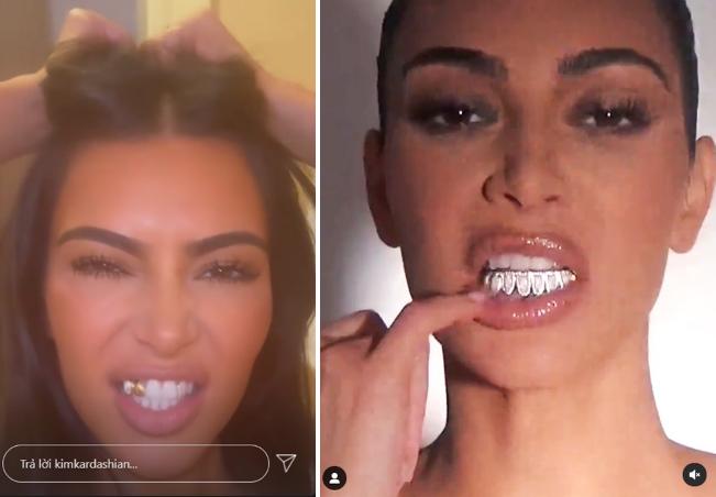 Kim Kardashian đính kim cương lên răng-1