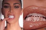 Kim Kardashian đính kim cương lên răng