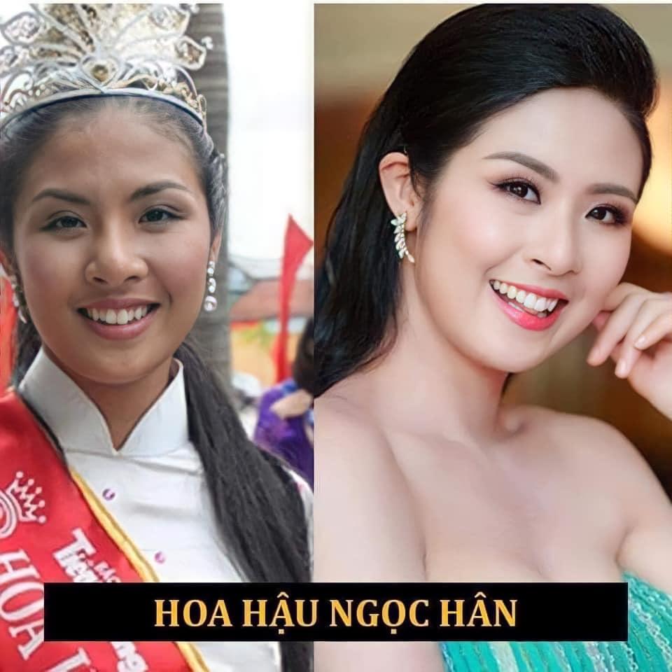 Khuyết điểm của Ngọc Hân chính là hàm răng khấp khểnh và làn da tối màu, đến nay mọi thứ đều đã được cải thiện.