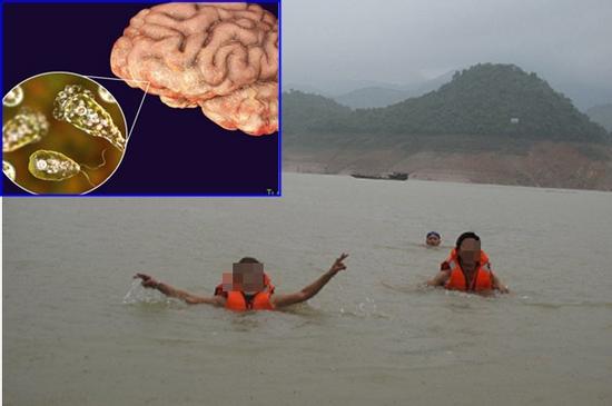 'Giải mã' căn bệnh nguy hiểm Amip ăn não người