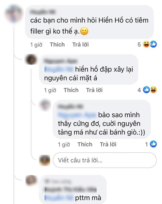 Hiền Hồ lộ cằm méo mó, gương mặt đơ cứng ngày càng vô hồn-3