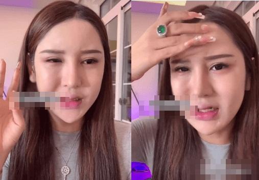 Hot girl 3 triệu follow trán lõm, mặt sưng phù do dao kéo quá đà-3