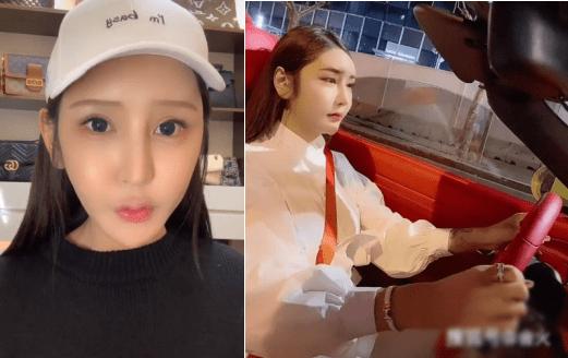 Hot girl 3 triệu follow trán lõm, mặt sưng phù do dao kéo quá đà-1