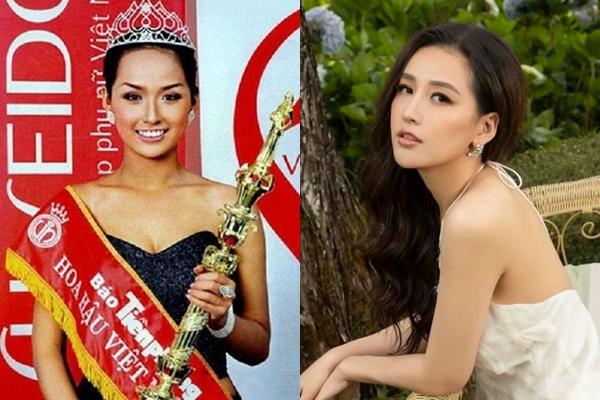 Mai Phương Thúy đẹp lên nhờ niềng răng: Sự thật có phải vậy?-3