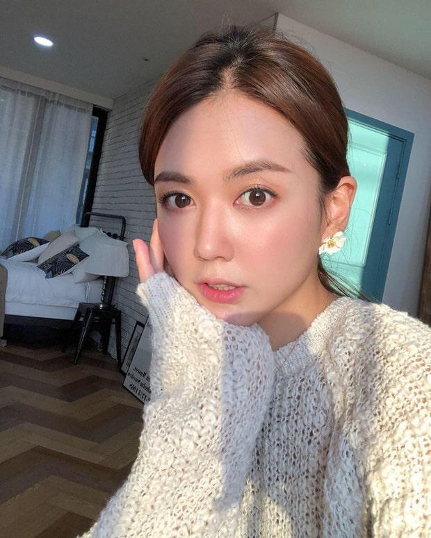 Từ A-Z về cấy chỉ căng da mặt - phương pháp trẻ hóa dung nhan đang hot rần rần-4