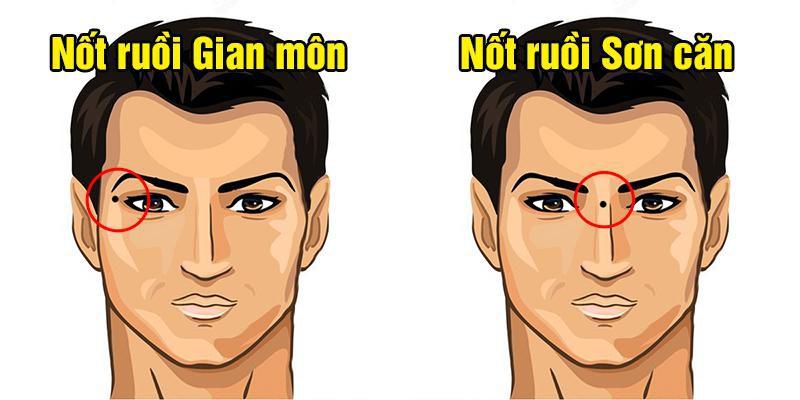 4 nốt ruồi cản trở tài lộc, càng giữ lại cuộc sống càng điêu đứng-1