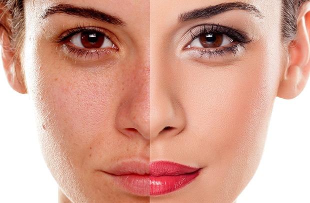 5 kẻ thù khiến da xỉn màu, đen sạm và cách cứu cánh-1