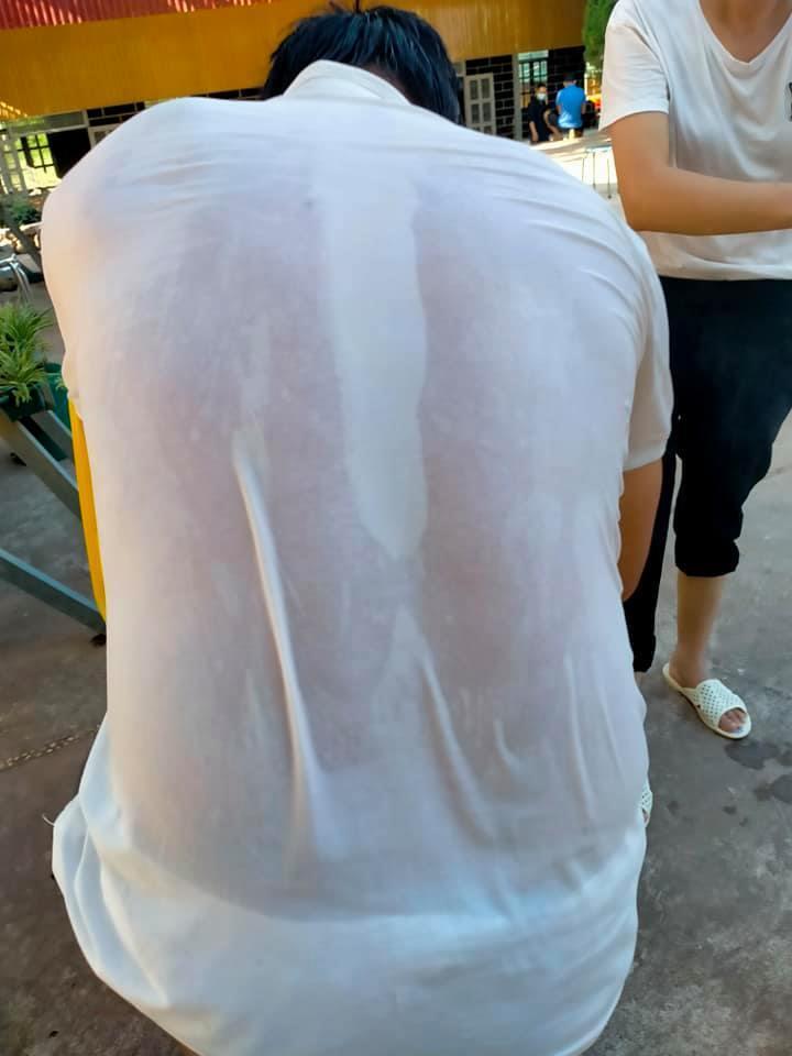 Xót xa hình ảnh bác sĩ chống dịch ngày nắng nóng-4