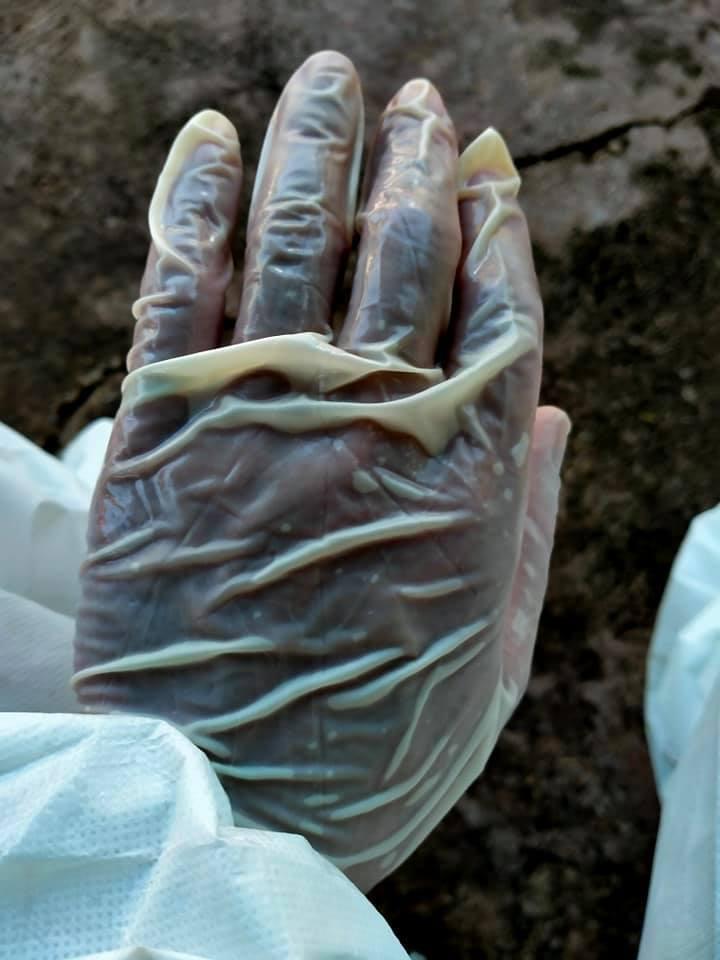 Xót xa hình ảnh bác sĩ chống dịch ngày nắng nóng-6