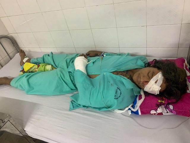 Chó Pitbull cắn chết người ở Long An: Vẫn chưa tìm ra danh tính nạn nhân-1