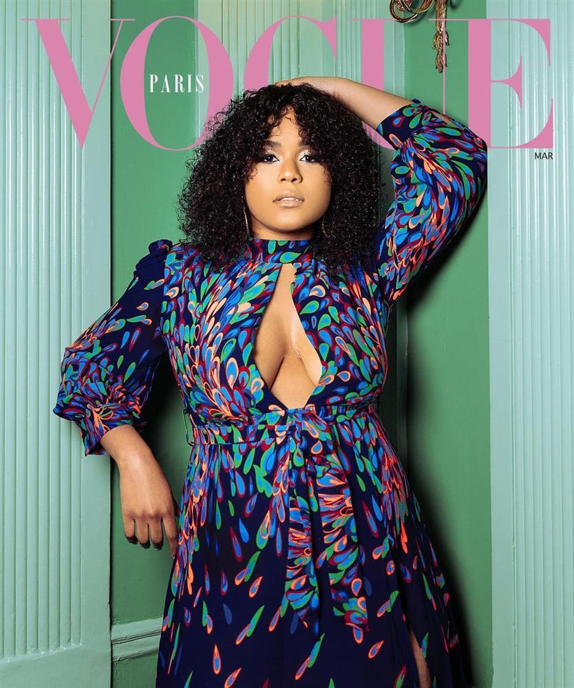 Người mẫu có chân trái sưng phù: Tôi đẹp từ trong ra ngoài-5