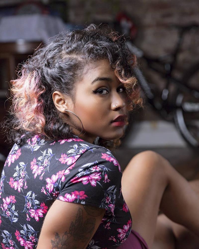 Người mẫu có chân trái sưng phù: Tôi đẹp từ trong ra ngoài-7