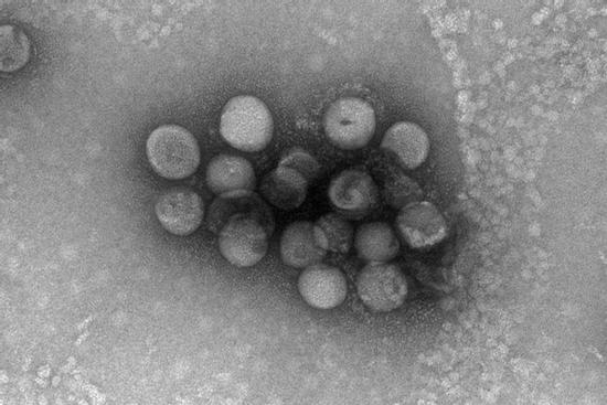Phát hiện chủng virus corona mới có nguồn gốc từ động vật