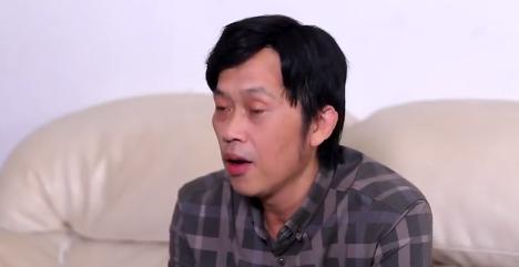 Nghệ sĩ Hoài Linh mặt hốc hác, mắt thâm quầng vì chuỗi scandal-4