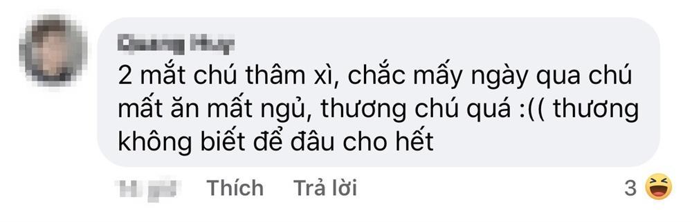 Nghệ sĩ Hoài Linh mặt hốc hác, mắt thâm quầng vì chuỗi scandal-6