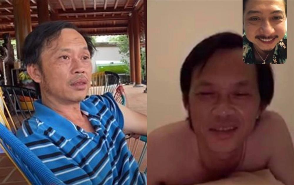 Nghệ sĩ Hoài Linh mặt hốc hác, mắt thâm quầng vì chuỗi scandal-10