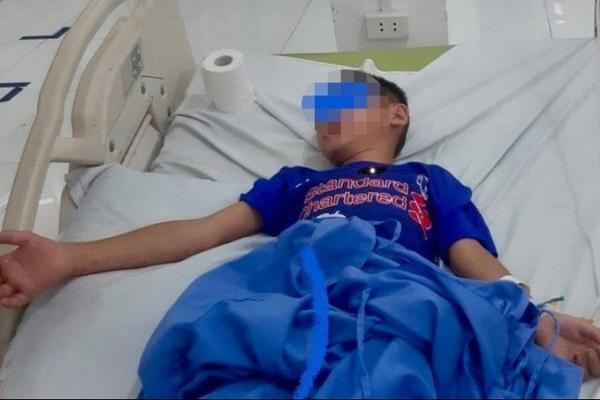 Đi vệ sinh, bé gái 3 tuổi khóc thét vi bị rắn hổ mang tấn công-4