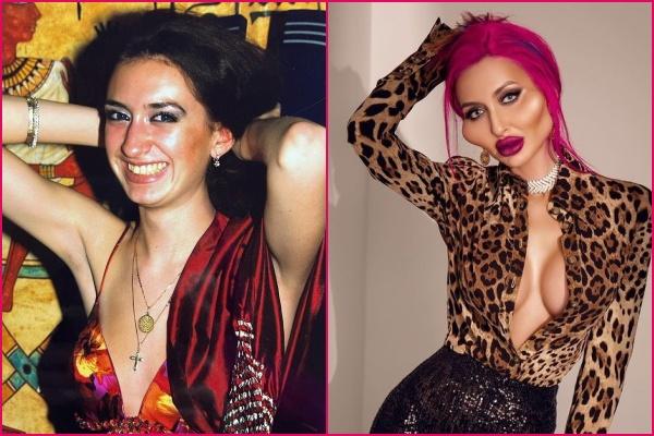 Bài học sau vụ siêu mẫu Linda Evangelista bị biến dạng ngoại hình-6