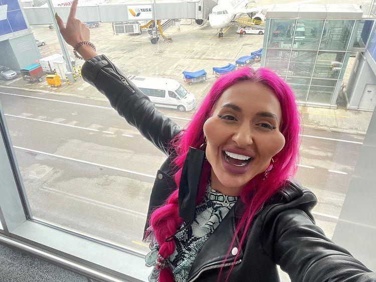 Người mẫu Ukraine nghiện tiêm filler đến biến dạng mặt-1