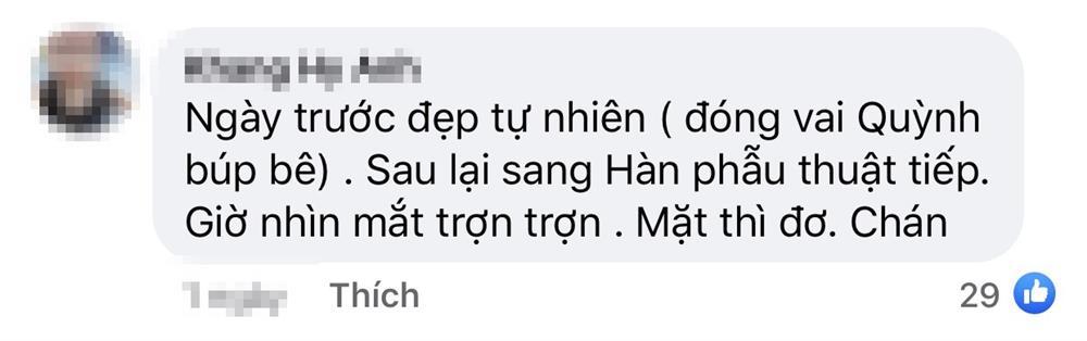 Phương Oanh Hương Vị Tình Thân bị chê mồm cá ngão, mặt đơ vì thẩm mỹ-6