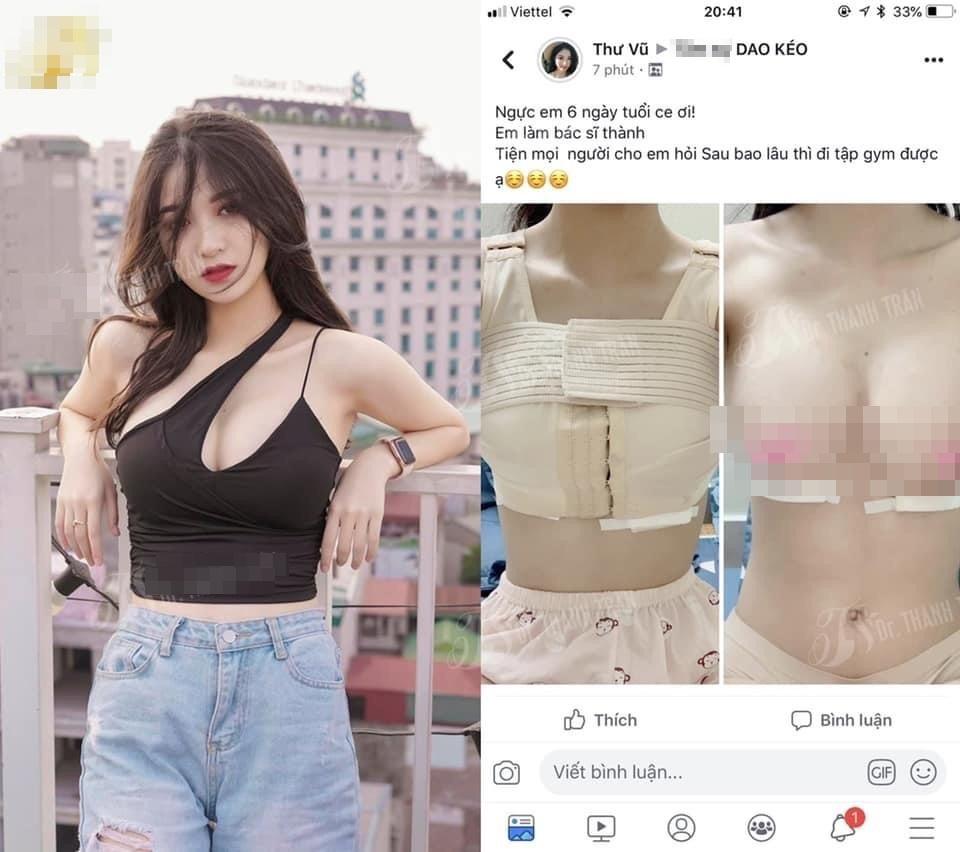 Anh Thư Về Nhà Đi Con lộ ảnh quá khứ vịt bầu, công khai nâng ngực-5