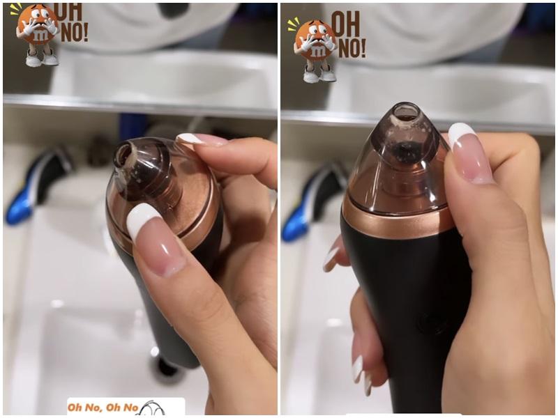 Máy hút mụn cầm tay đang hot: 10 điểm tiện lợi nhưng cần cẩn trọng!-2