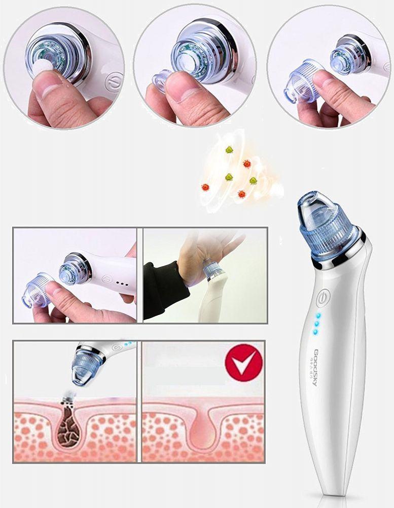 Máy hút mụn cầm tay đang hot: 10 điểm tiện lợi nhưng cần cẩn trọng!-4