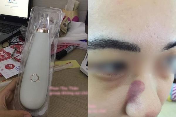 Máy hút mụn cầm tay đang hot: 10 điểm tiện lợi nhưng cần cẩn trọng!-5