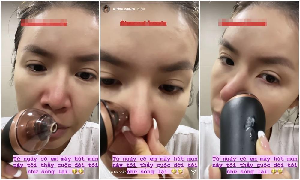 Máy hút mụn cầm tay đang hot: 10 điểm tiện lợi nhưng cần cẩn trọng!-1