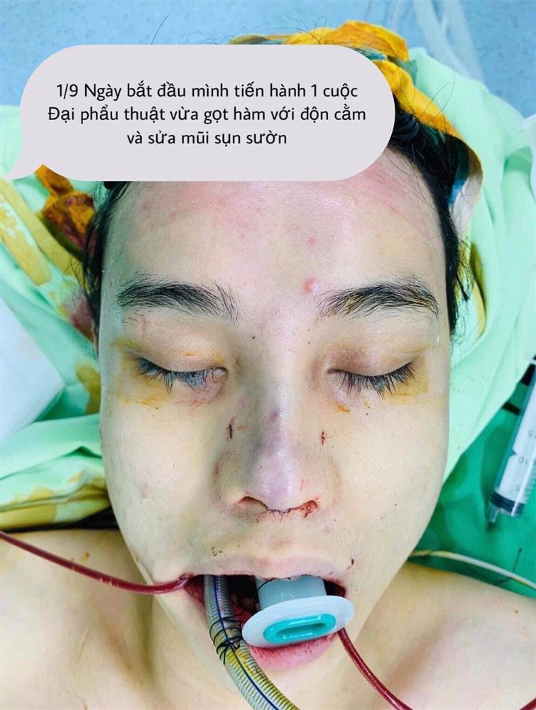 Mất 500 triệu chuyển giới, chàng trai biến hình visual nuột hơn gái duột-3